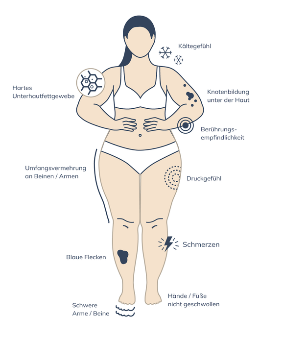 Grafik Symptome Lipödem, Plastische und Ästhetische Chirurgie Reutlingen, Prof. Dr. med. Manuel Held